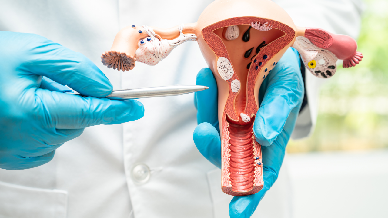 Coluna Saúde da Mulher Lídia Ferreira: Os Inimigos do Corpo da Mulher – Câncer Ginecológico