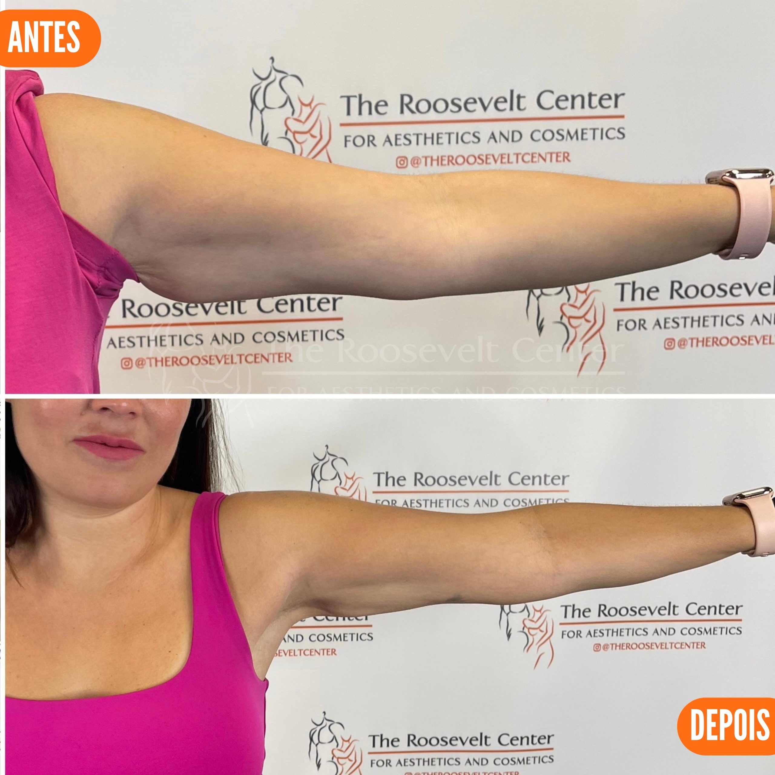 The Roselvelt Center oferece tratamentos estéticos avançados com atendimento em português