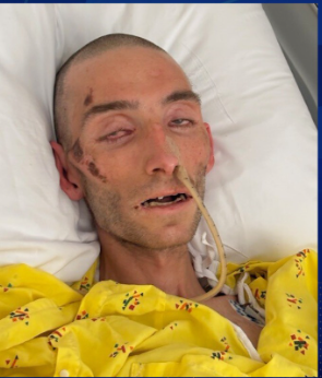 Hospital de Los Angeles pede ajuda para identificar paciente encontrado inconsciente
