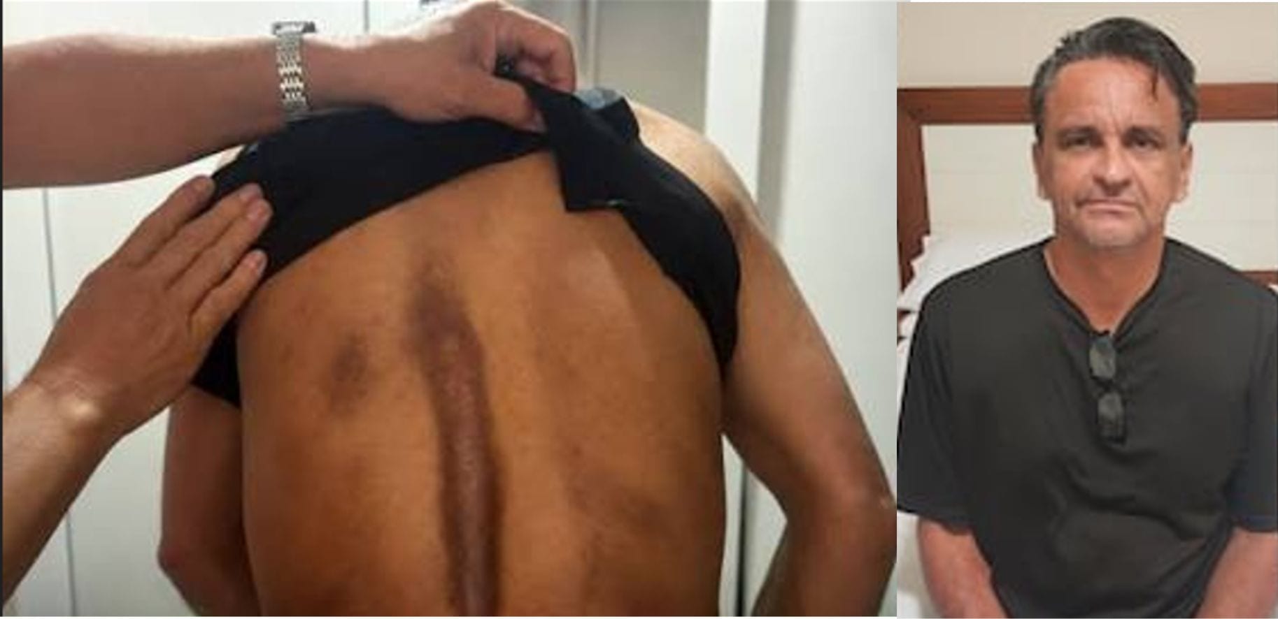 Brasileiro deportado denuncia uso de camisa de força e maus-tratos durante voo do ICE